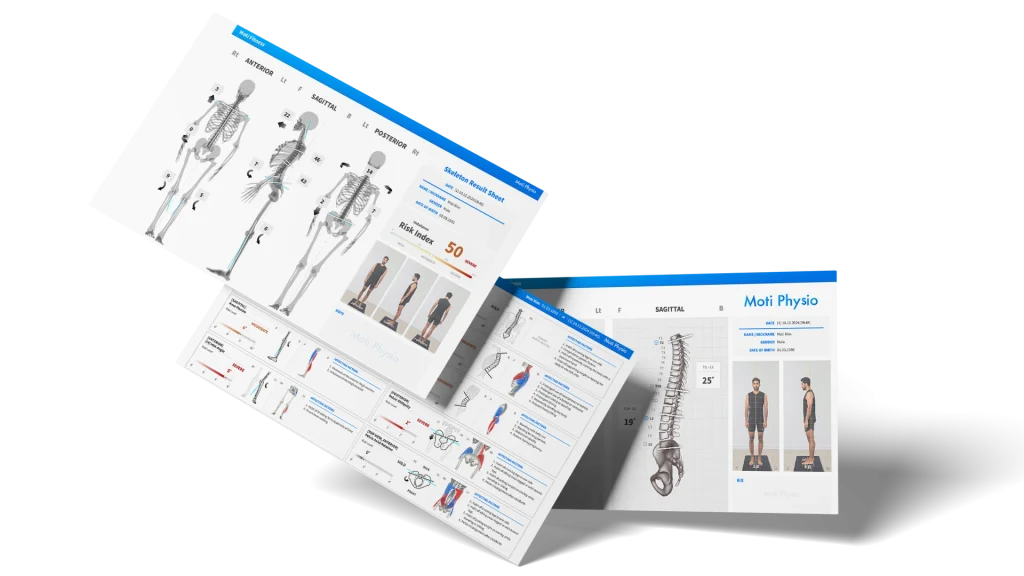 Prezentácia výstupov z diagnostiky MOTI Physio – anatomické modely a odporúčania pre terapiu