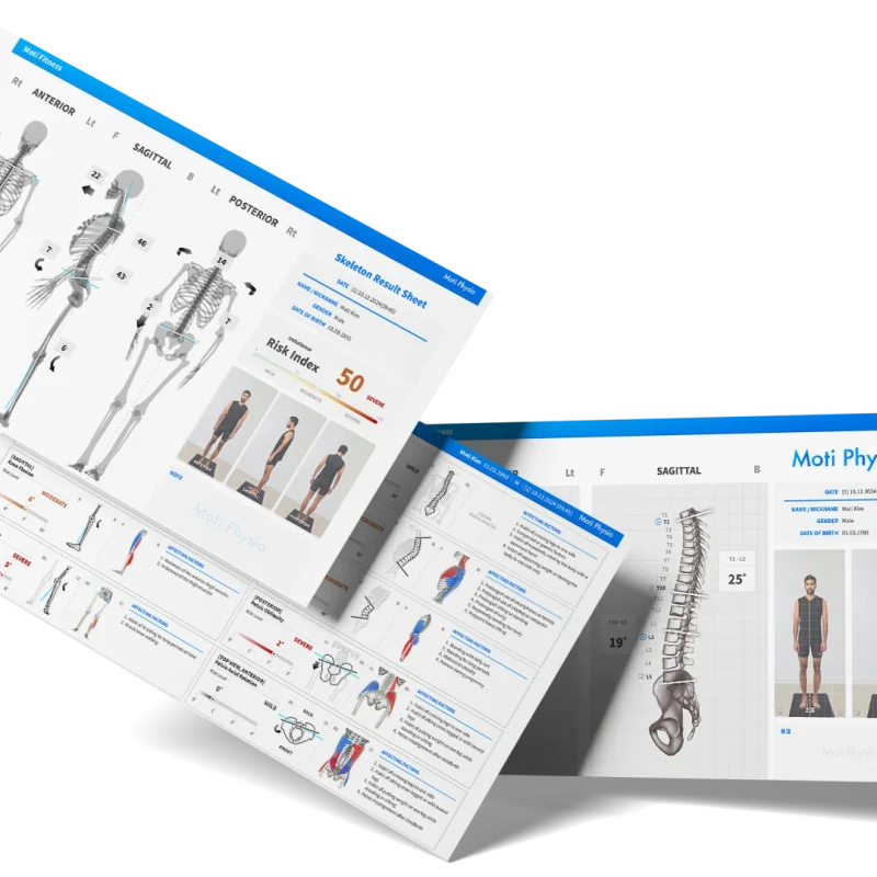 Prezentácia výstupov z diagnostiky MOTI Physio – anatomické modely a odporúčania pre terapiu